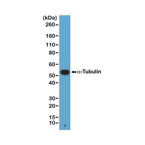 Figure 1. Western Blotting resultWestern blot of A431 cells, using Clone RM113 at 1/1000 dilution. A ?-Tubulin band showed at the predicted MW (~50 kDa).