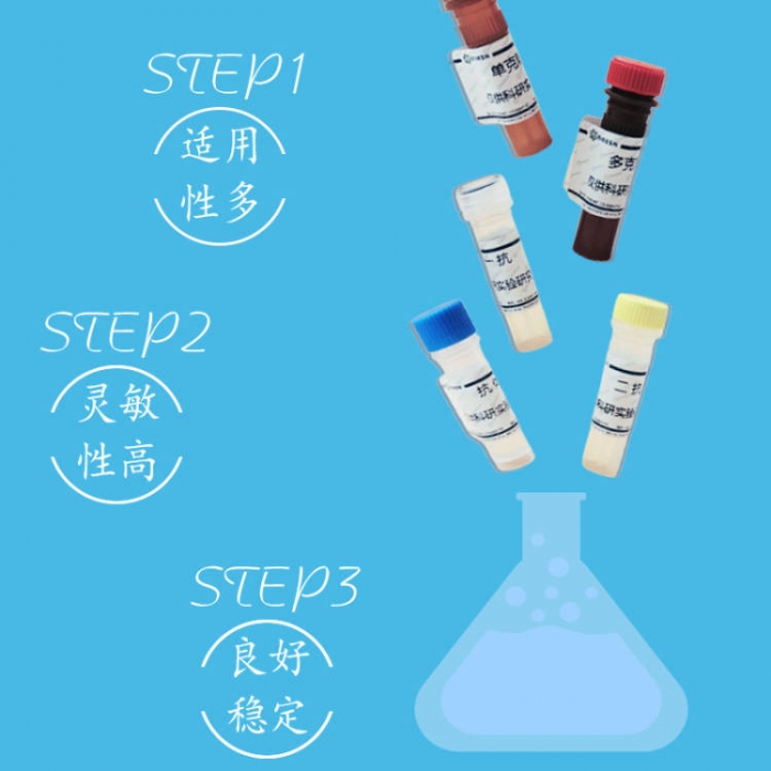 即日発送 LIN28 Antibody 博尔森生物科技有限公司-科研服务 - BES25382pAb 健康・医学